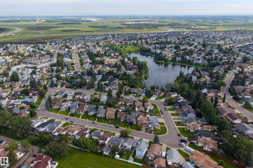 9328 175 Avenue Nw, Edmonton, AB - Outdoor With View