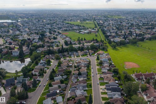 9328 175 Avenue Nw, Edmonton, AB - Outdoor With View