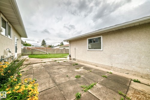 15020 88 Street Nw, Edmonton, AB - Outdoor With Exterior