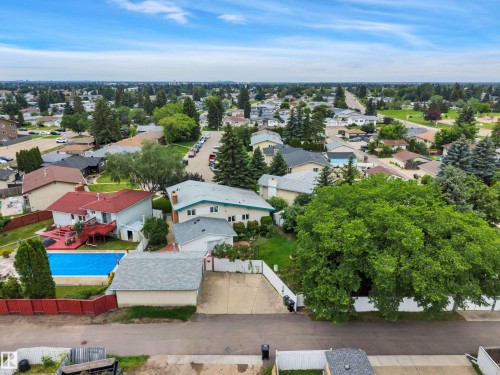 7604 149 Avenue Nw, Edmonton, AB - Outdoor With View