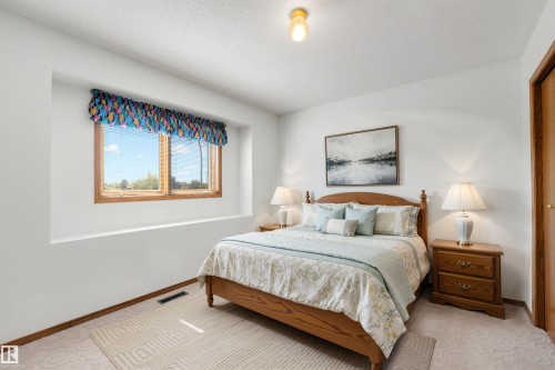 15304 74 Street Nw, Edmonton, AB - Indoor Photo Showing Bedroom