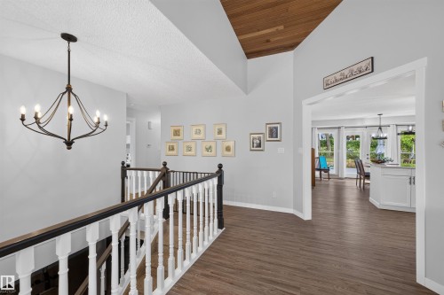 3 Hickory Crescent, Sherwood Park, AB 
