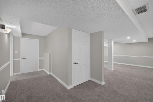 3 Hickory Crescent, Sherwood Park, AB 