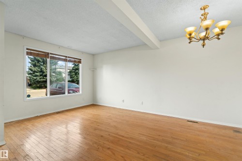 8313 156 Avenue Nw, Edmonton, AB 