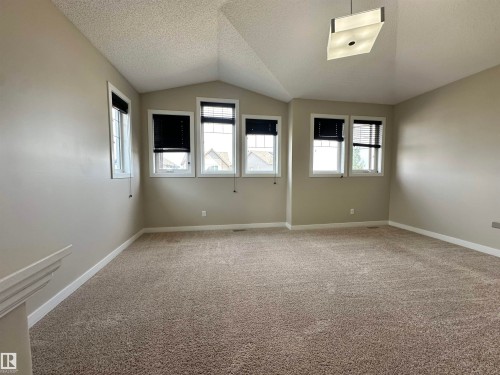 141 Sutton Close, Sherwood Park, AB 