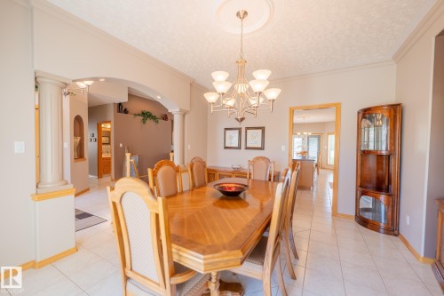 7707 166 Avenue Nw, Edmonton, AB 