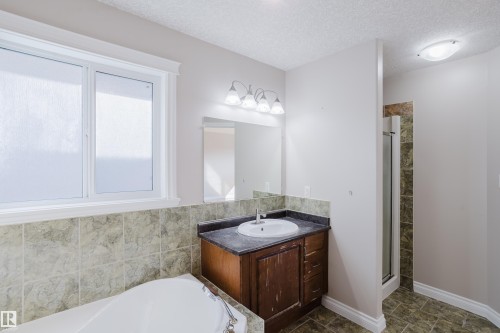 11616 174 Avenue Nw, Edmonton, AB 
