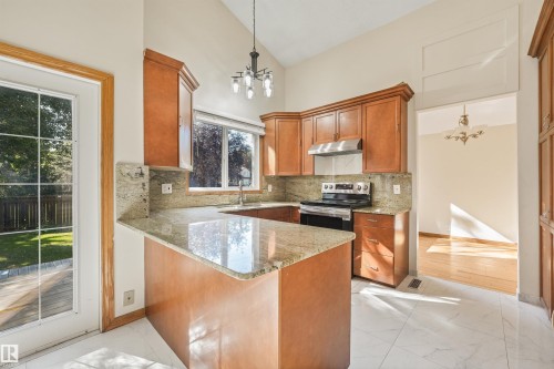 18623 70 Avenue Nw, Edmonton, AB 