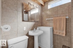 Pedestal sink with chrome faucet, medicine cabinet with integrated lighting, tiled walls, and a transom window providing natural light - 