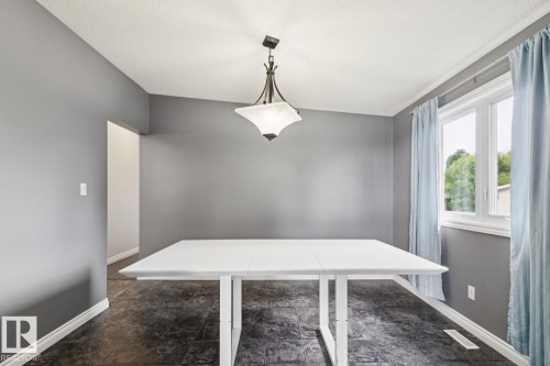 9312 151 Avenue Nw, Edmonton, AB 