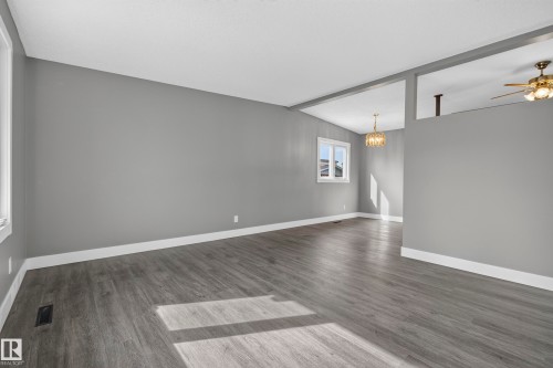 25 Milburn Crescent, Sherwood Park, AB 