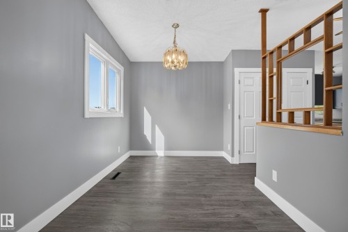 25 Milburn Crescent, Sherwood Park, AB 