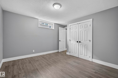 25 Milburn Crescent, Sherwood Park, AB 