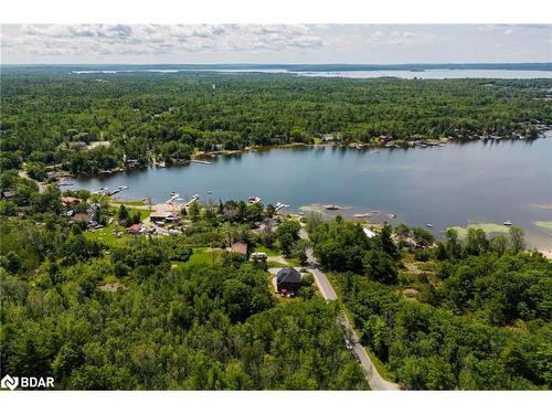 94 Macey Bay Road, Port Severn, ON - Outdoor With Body Of Water With View
