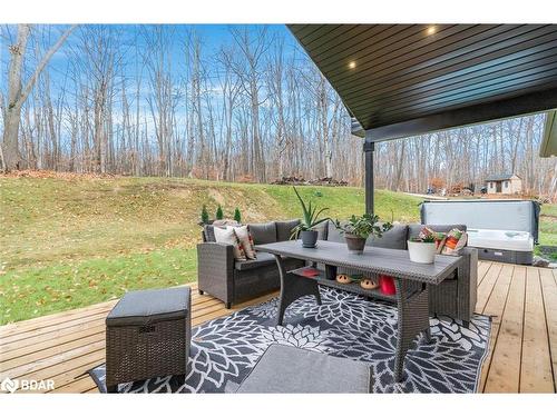 1532 Champlain Road, Tiny, ON - Outdoor With Deck Patio Veranda With Exterior