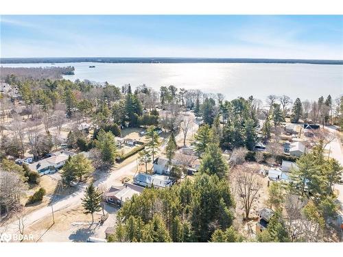 3314 Pleasant Road, Severn, ON - Outdoor With Body Of Water With View