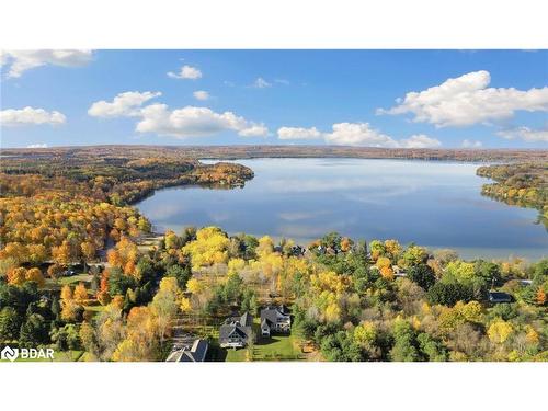 1167 15 Line N, Oro-Medonte, ON - Outdoor With Body Of Water With View