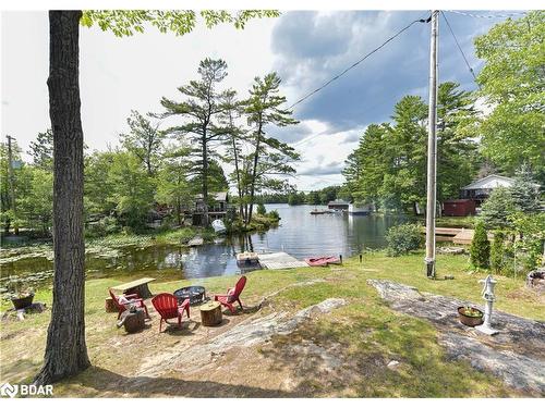 6881 Upper Big Chute Road, Coldwater, ON - Outdoor With Body Of Water With View