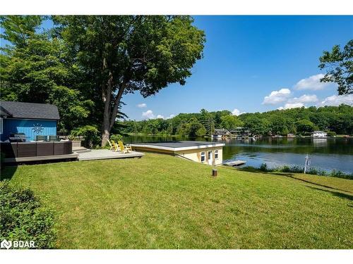51 Sugarbush Trail, Fenelon Falls, ON - Outdoor With Body Of Water With View