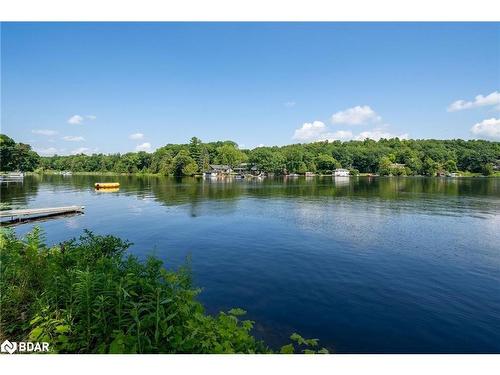51 Sugarbush Trail, Fenelon Falls, ON - Outdoor With Body Of Water With View