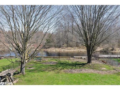 15 Lankin Boulevard, Orillia, ON - Outdoor With View