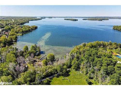 4001 Longford Mills Road, Ramara, ON - Outdoor With Body Of Water With View