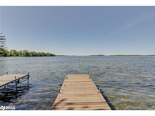 4001 Longford Mills Road, Ramara, ON - Outdoor With Body Of Water With View