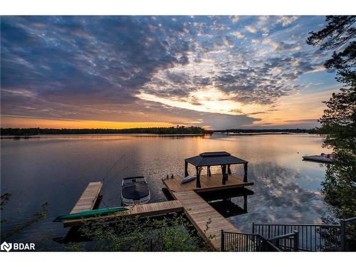 1059 Torpitt Road, Severn Bridge, ON - Outdoor With Body Of Water With View