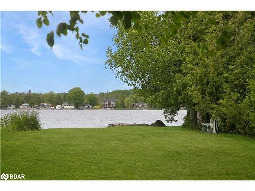 43 Sturgeon Glen Road, Fenelon Falls, ON - Outdoor With View