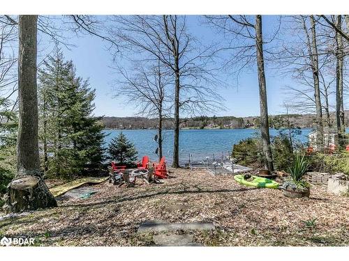 176 Farlain Lake Road E, Tiny, ON - Outdoor With Body Of Water With View