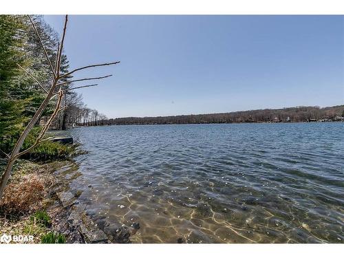 176 Farlain Lake Road E, Tiny, ON - Outdoor With Body Of Water With View