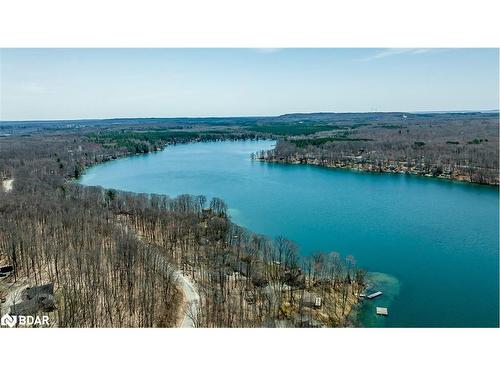 176 Farlain Lake Road E, Tiny, ON - Outdoor With Body Of Water With View