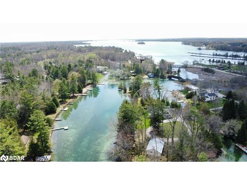 8272 Rama Road, Washago, ON - Outdoor With Body Of Water With View