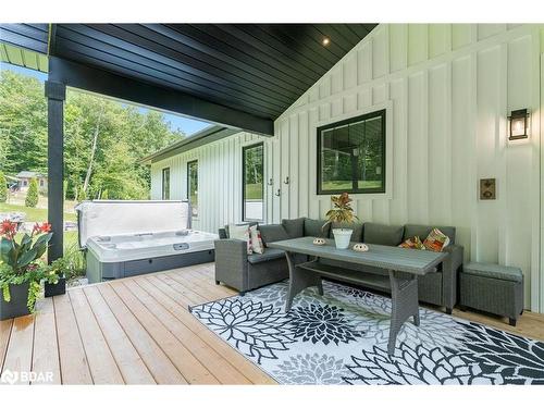 1532 Champlain Road, Tiny, ON - Outdoor With Deck Patio Veranda With Exterior