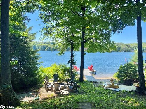 176 Farlain Lake Road E, Tiny, ON - Outdoor With Body Of Water With View