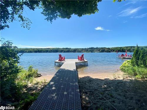 176 Farlain Lake Road E, Tiny, ON - Outdoor With Body Of Water With View