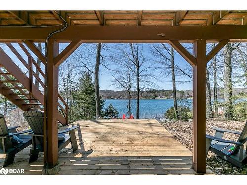 176 Farlain Lake Road E, Tiny, ON - Outdoor With Body Of Water