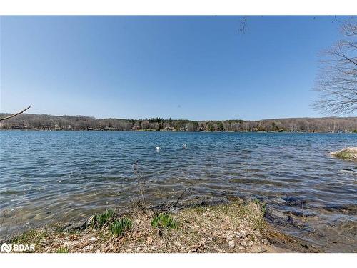 176 Farlain Lake Road E, Tiny, ON - Outdoor With Body Of Water With View