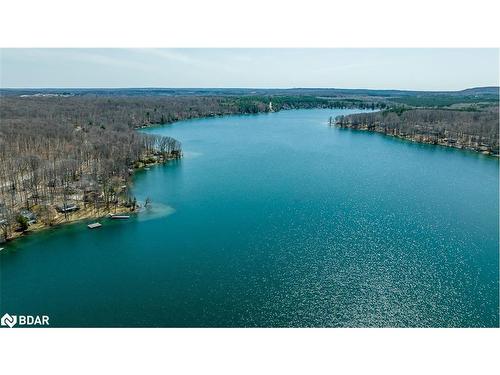 176 Farlain Lake Road E, Tiny, ON - Outdoor With Body Of Water With View