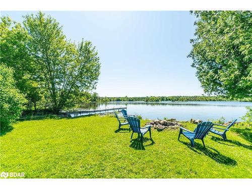 159 Mcguire Beach Rd Road, Kawartha Lakes, ON - Outdoor With Body Of Water With View