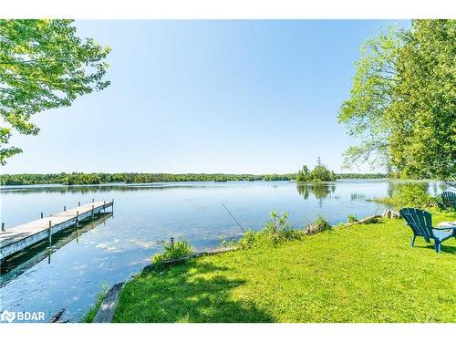 159 Mcguire Beach Rd Road, Kawartha Lakes, ON - Outdoor With Body Of Water With View