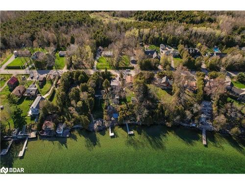 2371 Lakeshore Road E, Oro-Medonte, ON - Outdoor With View