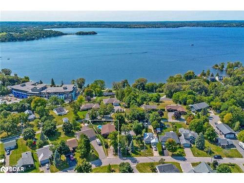 121 Queen Street Street, Fenelon Falls, ON - Outdoor With Body Of Water With View