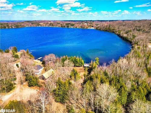 7 Beach Road, Oro-Medonte, ON - Outdoor With Body Of Water With View