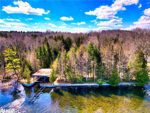 7 Beach Road, Oro-Medonte, ON - Outdoor With Body Of Water With View