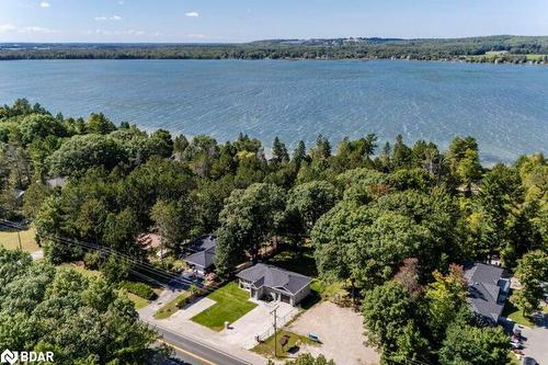 2386 South Orr Lake Road, Elmvale, ON - Outdoor With Body Of Water With View