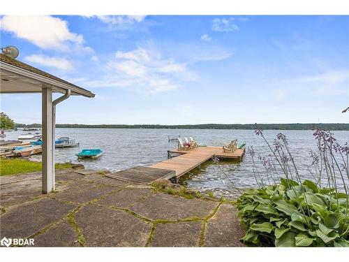 2240 South Orr Lake Road, Elmvale, ON - Outdoor With Body Of Water With View