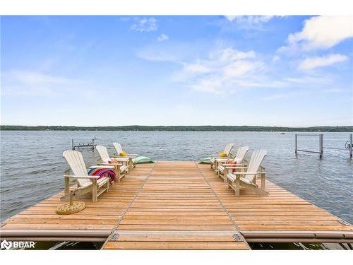 2240 South Orr Lake Road, Elmvale, ON - Outdoor With Body Of Water With View