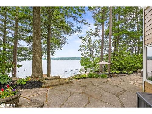 2240 South Orr Lake Road, Elmvale, ON - Outdoor With Body Of Water