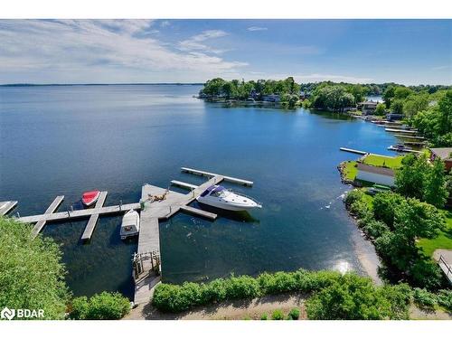 401-140 Cedar Island Road, Orillia, ON - Outdoor With Body Of Water With View